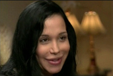 nadya suleman plastic surgery before and after. Nadya Suleman gt; Octuplets